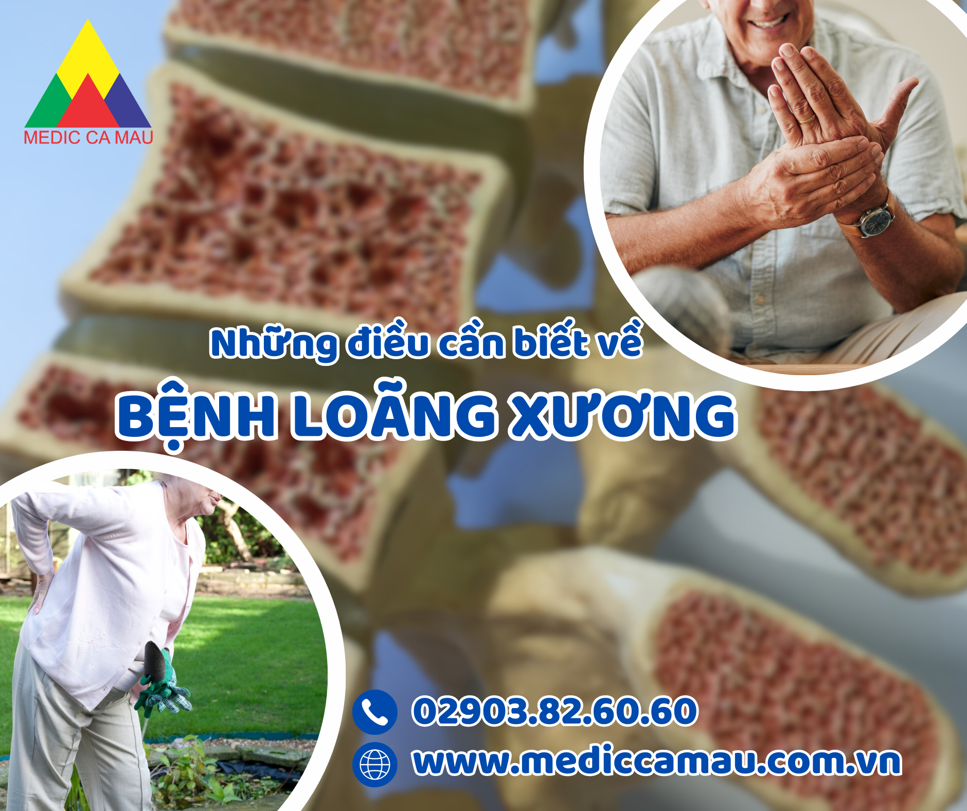 LOÃNG XƯƠNG – NGUY CƠ THẦM LẶNG VÀ CÁCH CHỮA